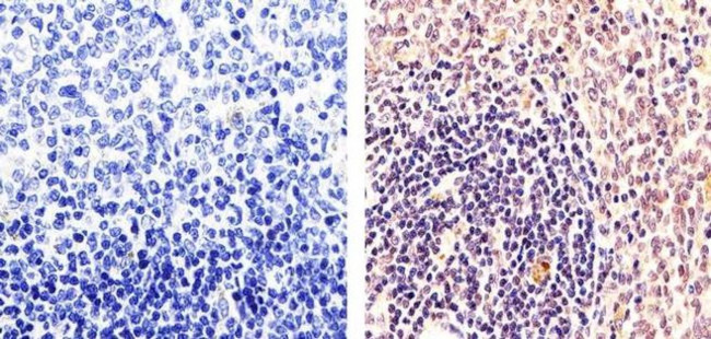 PARP1 Antibody in Immunohistochemistry (Paraffin) (IHC (P))