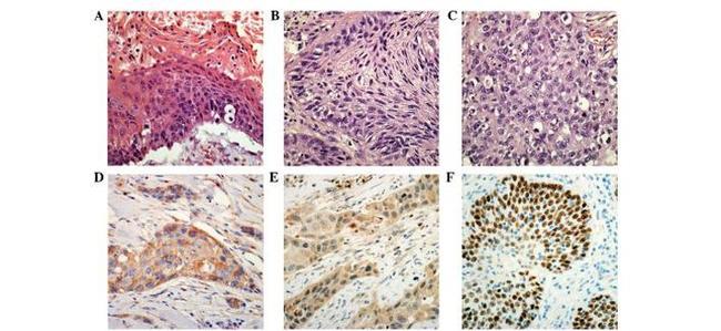 VEGF Receptor 2 Antibody in Immunohistochemistry (Paraffin) (IHC (P))