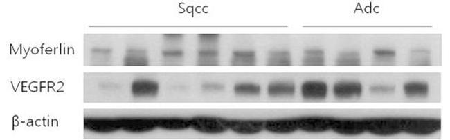 VEGF Receptor 2 Antibody in Western Blot (WB)