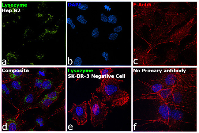 Lysozyme Antibody in Immunocytochemistry (ICC/IF)