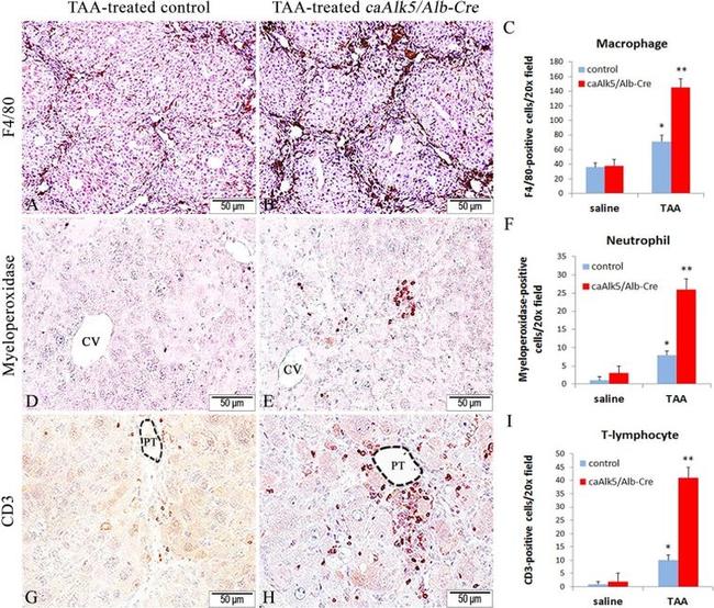 Myeloperoxidase Antibody in Immunohistochemistry (IHC)