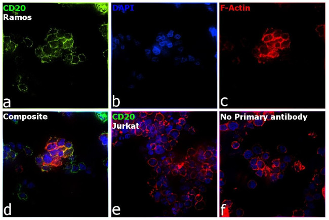 CD20 Antibody in Immunocytochemistry (ICC/IF)