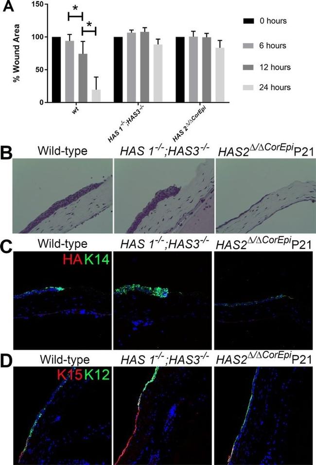 Cytokeratin 14 Antibody in Immunohistochemistry (IHC)