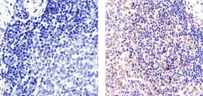 NFkB p65 Antibody in Immunohistochemistry (Paraffin) (IHC (P))