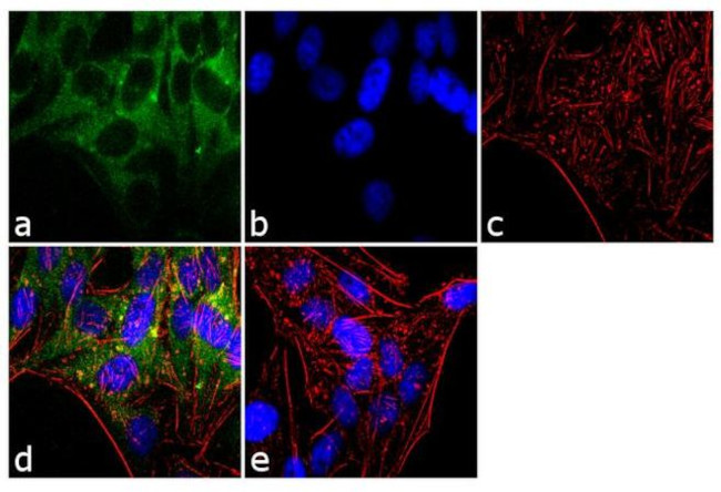 NFkB p65 Antibody in Immunocytochemistry (ICC/IF)