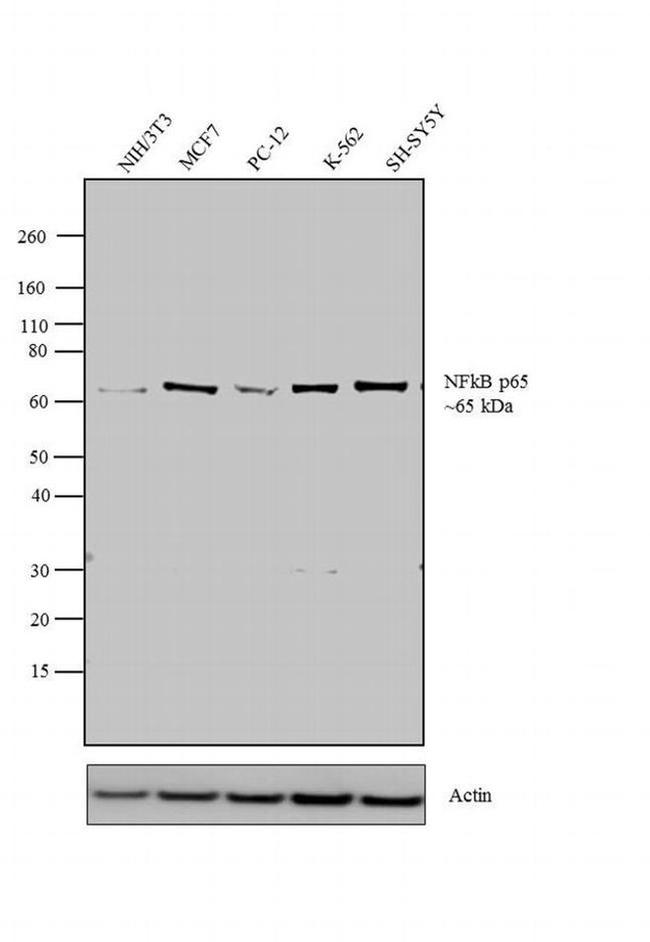 NFkB p65 Antibody in Western Blot (WB)