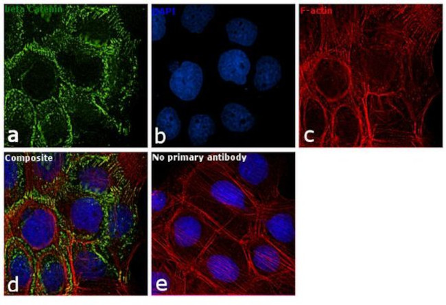 beta Catenin Antibody in Immunocytochemistry (ICC/IF)