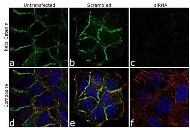 beta Catenin Antibody in Immunocytochemistry (ICC/IF)