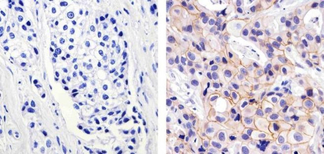 ErbB2 (HER-2) Antibody in Immunohistochemistry (Paraffin) (IHC (P))