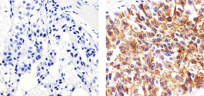 MUC1 Antibody in Immunohistochemistry (Paraffin) (IHC (P))