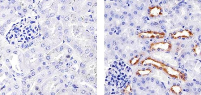 MUC1 Antibody in Immunohistochemistry (Paraffin) (IHC (P))