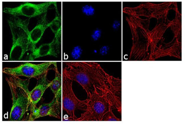 beta Tubulin Antibody in Immunocytochemistry (ICC/IF)