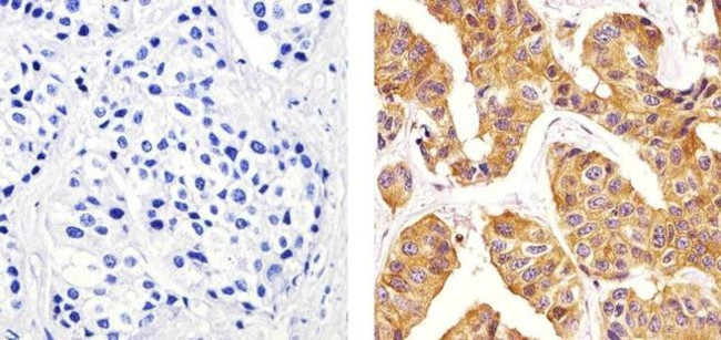 beta Tubulin Antibody in Immunohistochemistry (Paraffin) (IHC (P))