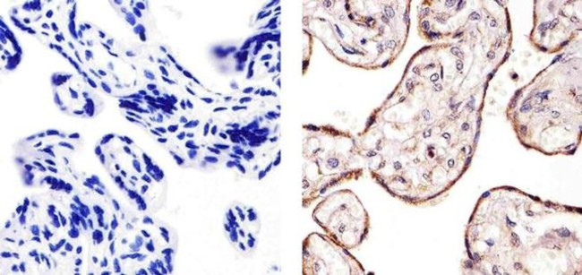 VEGF Receptor 3 Antibody in Immunohistochemistry (Paraffin) (IHC (P))