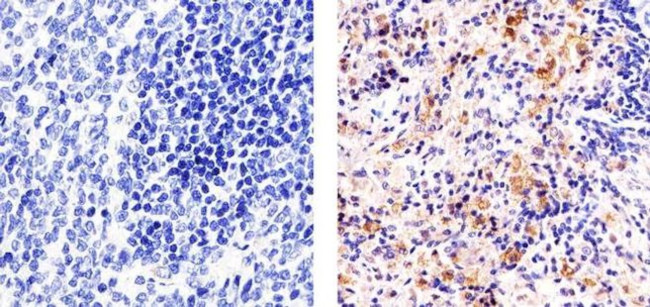 VEGF Receptor 3 Antibody in Immunohistochemistry (Paraffin) (IHC (P))