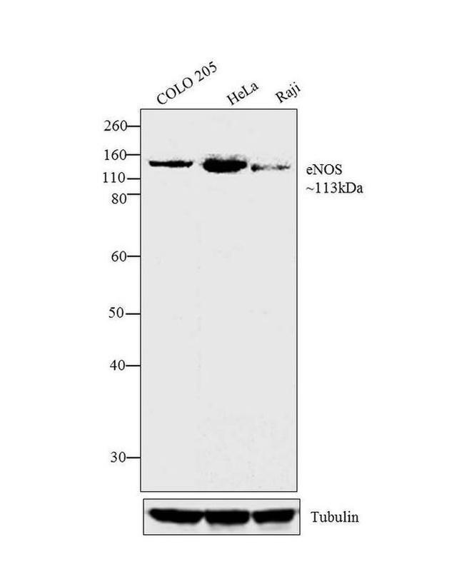 eNOS Antibody in Western Blot (WB)