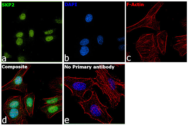 SKP2 Antibody in Immunocytochemistry (ICC/IF)