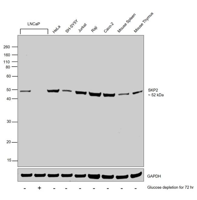 SKP2 Antibody in Western Blot (WB)