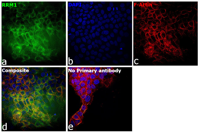 RRM1 Antibody in Immunocytochemistry (ICC/IF)