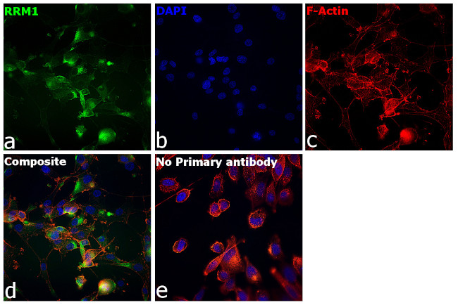 RRM1 Antibody in Immunocytochemistry (ICC/IF)