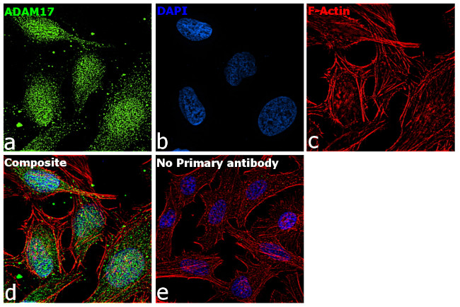 ADAM17 Antibody in Immunocytochemistry (ICC/IF)