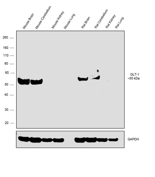 GLT-1 Antibody in Western Blot (WB)