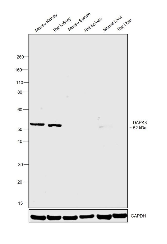 ZIPK Antibody in Western Blot (WB)