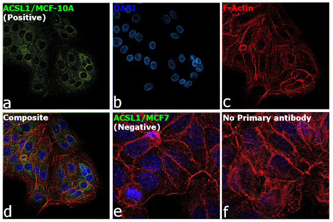 ACSL1 Antibody in Immunocytochemistry (ICC/IF)