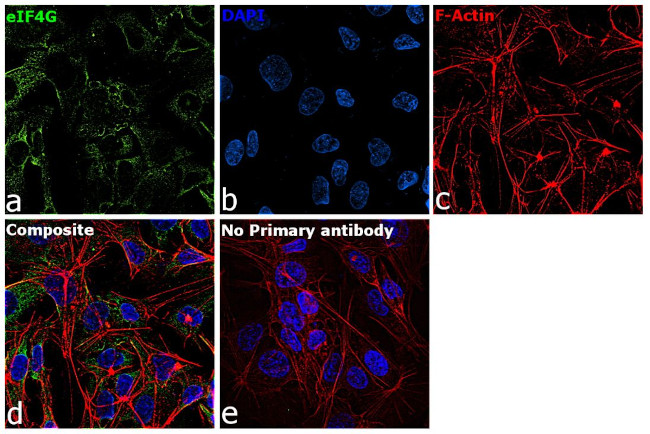 eIF4G Antibody in Immunocytochemistry (ICC/IF)