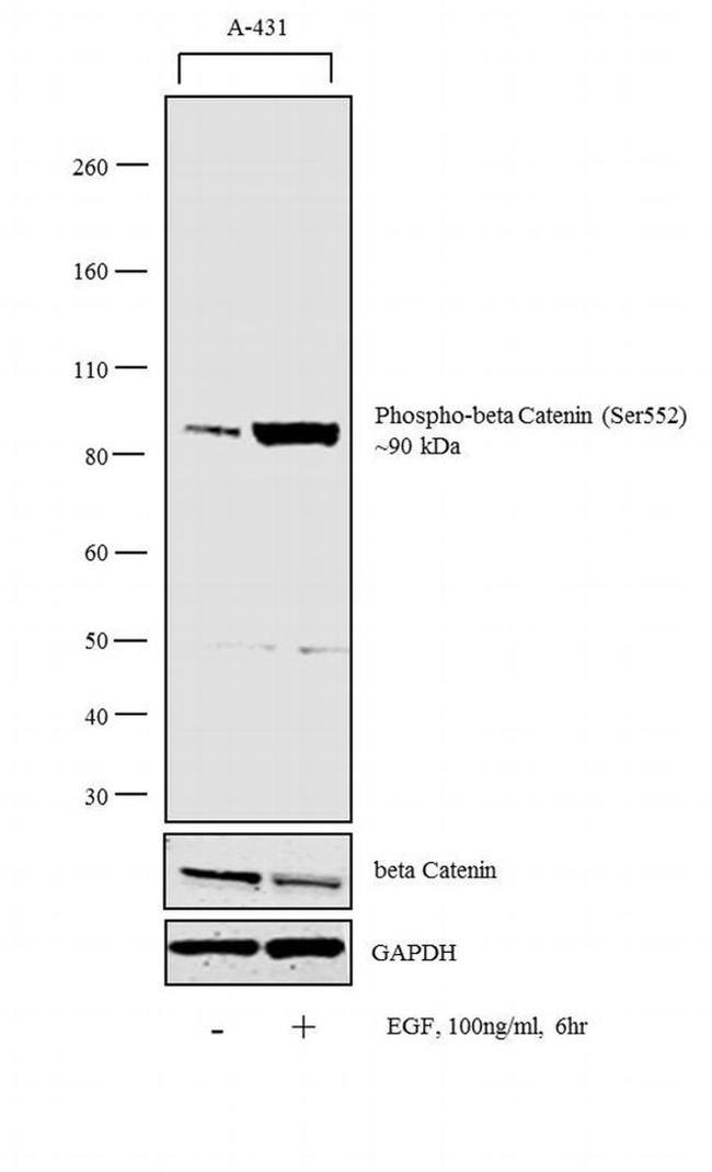 Phospho-beta Catenin (Ser552) Antibody in Western Blot (WB)
