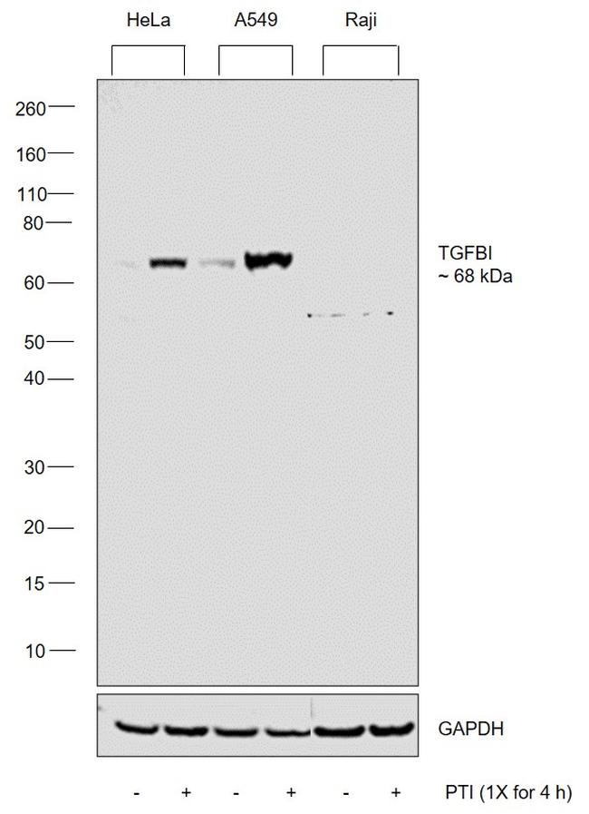 TGFBI Antibody in Western Blot (WB)