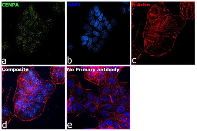 CENPA Antibody in Immunocytochemistry (ICC/IF)