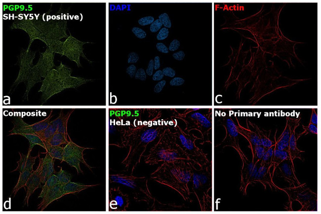 PGP9.5 Antibody in Immunocytochemistry (ICC/IF)