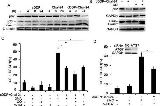 ATG7 Antibody in Western Blot (WB)