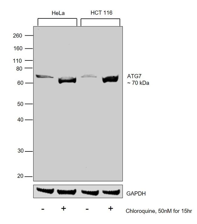 ATG7 Antibody in Western Blot (WB)