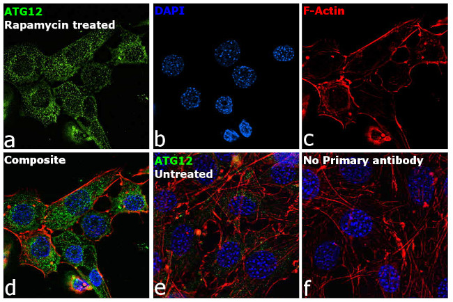 ATG12 Antibody in Immunocytochemistry (ICC/IF)