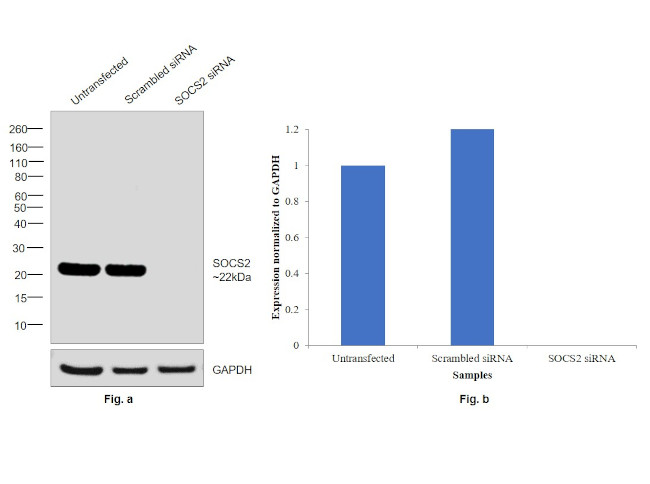 SOCS2 Antibody