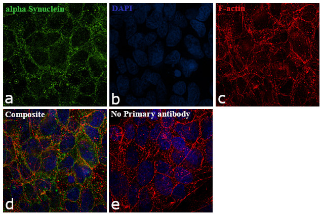 alpha Synuclein Antibody in Immunocytochemistry (ICC/IF)