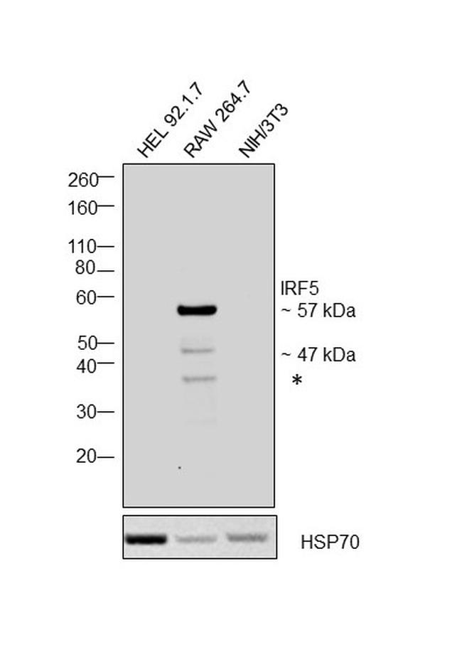 IRF5 Antibody in Western Blot (WB)