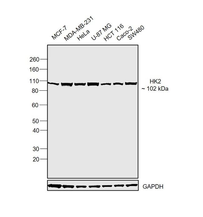 HK2 Antibody in Western Blot (WB)