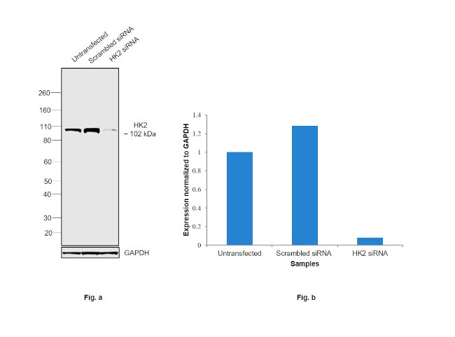 HK2 Antibody