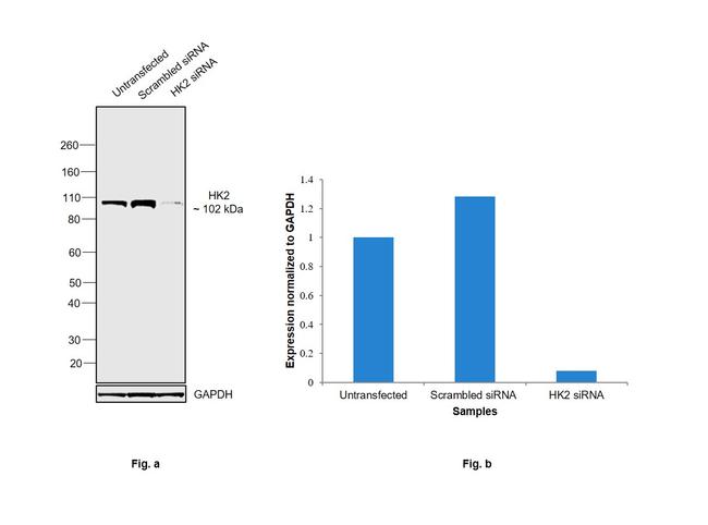 HK2 Antibody in Western Blot (WB)