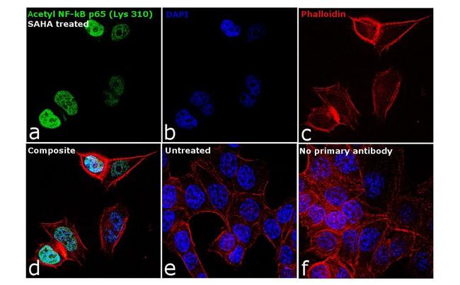 Acetyl-NFkB p65 (Lys310) Antibody