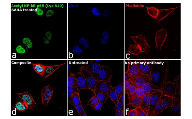 Acetyl-NFkB p65 (Lys310) Antibody in Immunocytochemistry (ICC/IF)