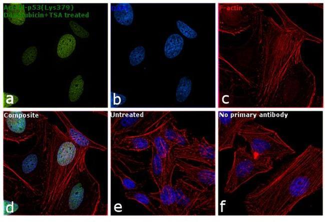 Acetyl-p53 (Lys379) Antibody