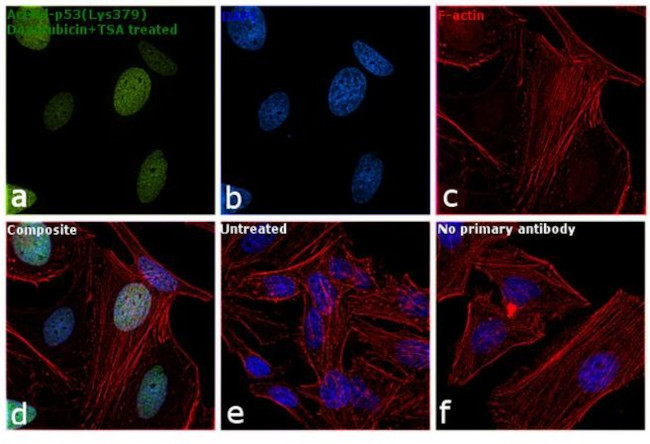 Acetyl-p53 (Lys379) Antibody in Immunocytochemistry (ICC/IF)