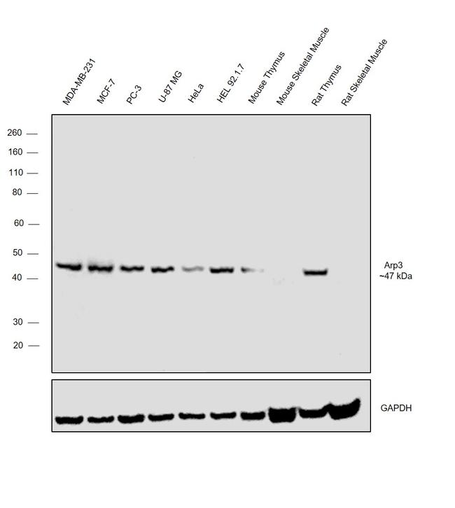 Arp3 Antibody in Western Blot (WB)