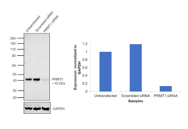 PRMT1 Antibody