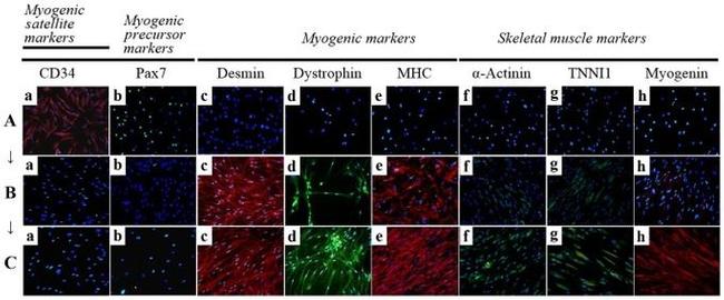 alpha Actinin 1 Antibody in Immunocytochemistry (ICC/IF)