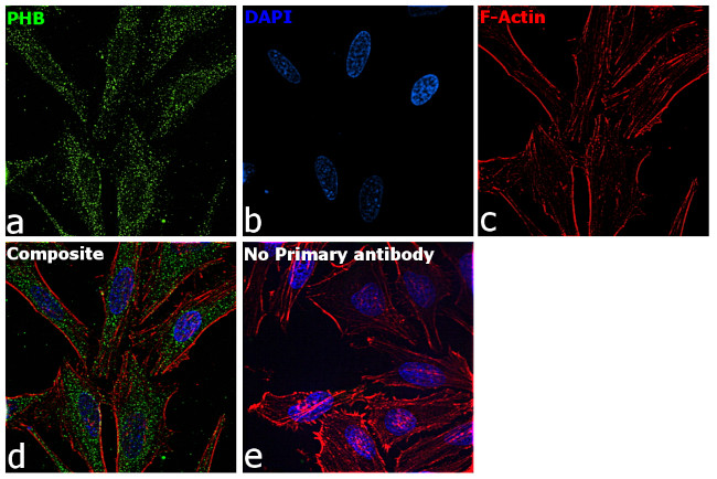 Prohibitin Antibody in Immunocytochemistry (ICC/IF)